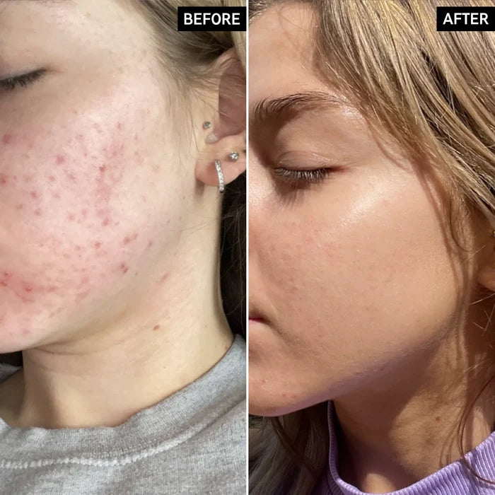 THE INKEY LIST niacinamide serum formulated for all سيروم النياسينمايد من ذا انكي لست
